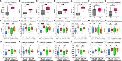 Ferroptosis of CD163+ tissue-infiltrating macrophages and CD10+ PC+ epithelial cells in lupus nephritis